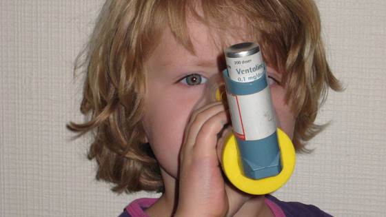 Ingen sammenheng mellom muggsopp og utvikling av astma og allergi