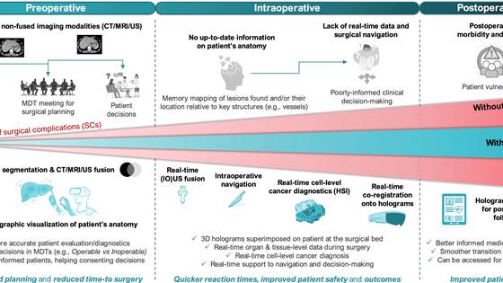 HoloSurge: Holographic Guidance System for Interventions on Liver and Pancreatic Cancers