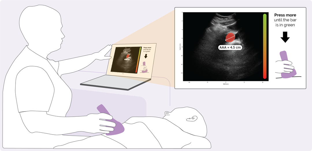 Point of Care Ultrasound Technology (POCUS) With AI