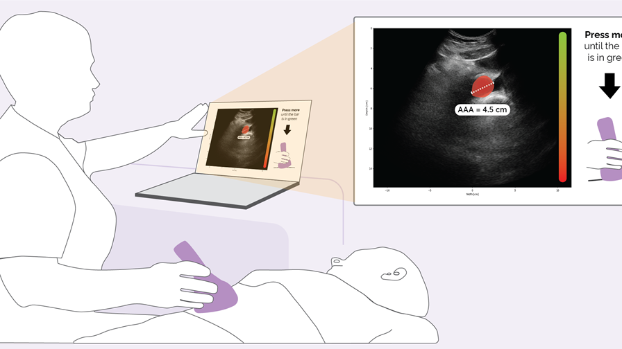 AI POCUS AAA - Artificial Intelligence guided Point-Of-Care UltraSound in remote areas on Abdominal Aortic Aneurysm