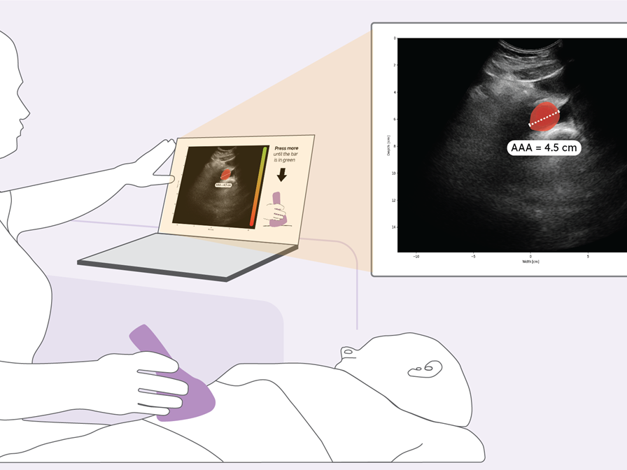 Pocus Aaa SINTEF Industry