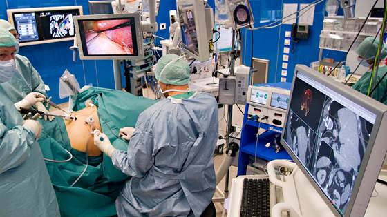 Laparoskopi – Nasjonal kompetansetjeneste for ultralyd og bildeveiledet behandling