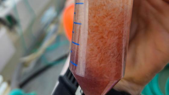 Finding and catching Calanus