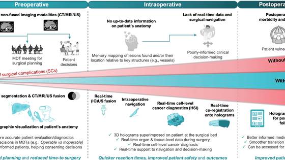 HoloSurge: Holografisk veiledningssystem for intervensjoner ved lever- og bukspyttkjertelkreft