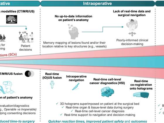 HoloSurge: Holografisk veiledningssystem for intervensjoner ved lever- og bukspyttkjertelkreft