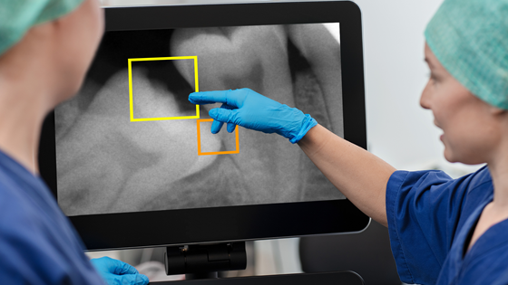 AI-basert analyse av bilder i tannhelse
