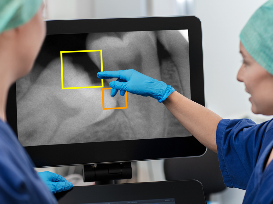 AI-basert analyse av bilder i tannhelse
