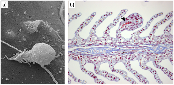 Figure 1: a) Discharged stinging cell of the hydroid E. larynx, and b) a gill filament showing injury after exposure to hydroids