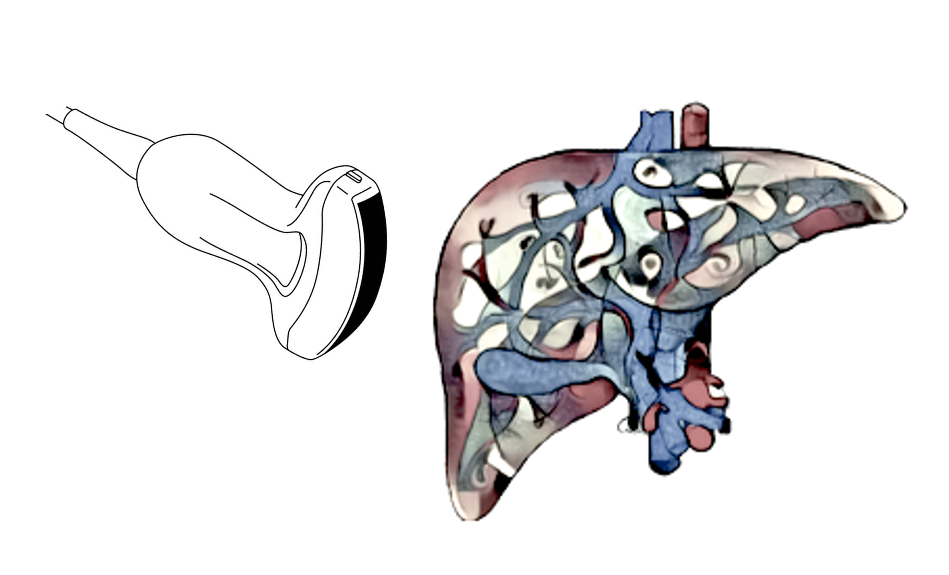 Quantitative measurement of fat content in liver with ultrasound