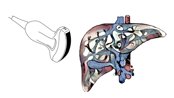 Quantitative measurement of fat content in liver with ultrasound