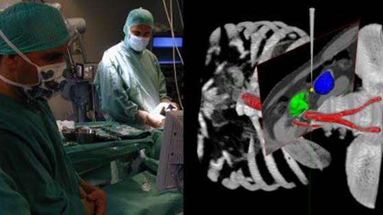 E-læringsverktøy for kirurger