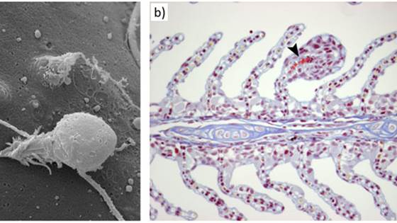 HydroDetect -utvikling av et diagnoseverktøy for gjelleskader fra nesledyr