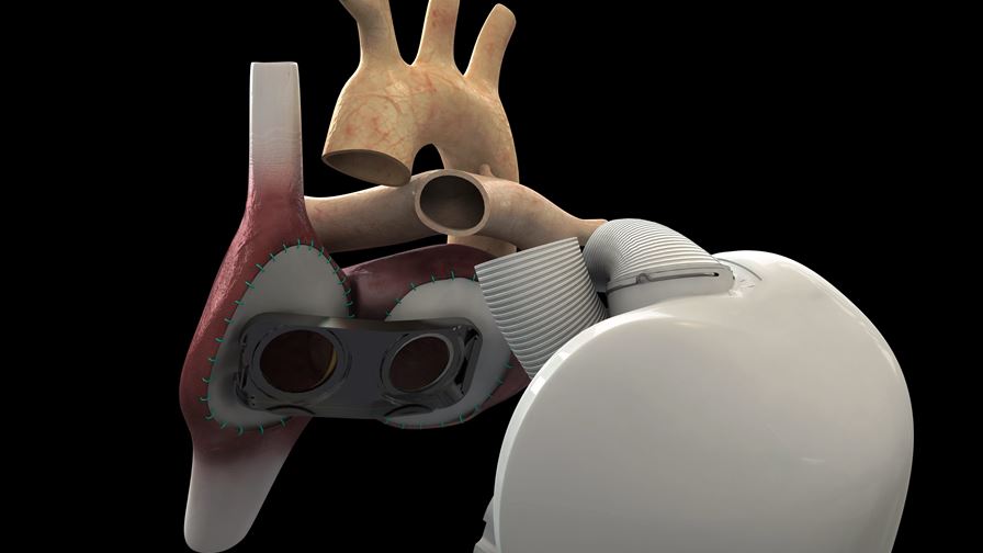 Artificial heart with Norwegian sensor