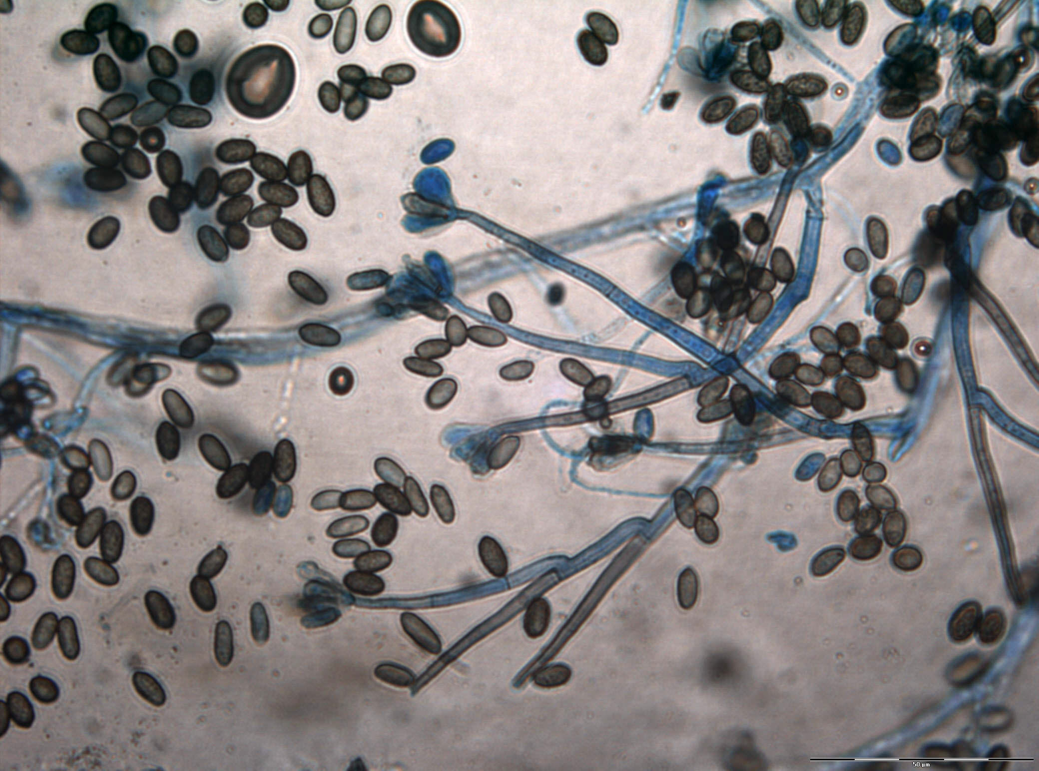 Muggsopp ikke farlig likevel? 