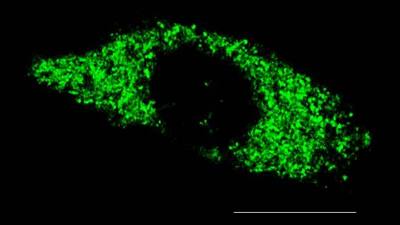 Biodegradable Nanoparticles in Cancer Diagnosis and Therapy
