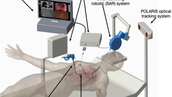 IDEAR: Forbedre kreftdiagnostikk innenfor fiberskopi (fleksibel endoskopi) ved bruk av kunstig intelligens og medisinsk robotikk