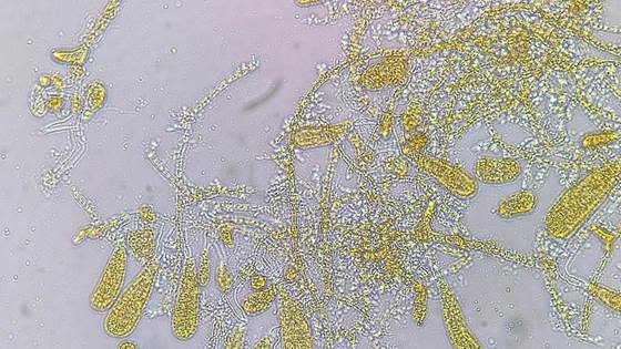 DIRECT – optimising direct seeding for kelp cultivation