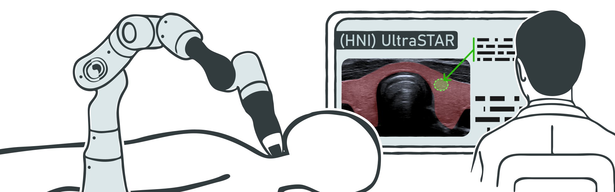 Robot-assisted ultrasound examination of thyroid nodules — (HNI) UltraSTAR