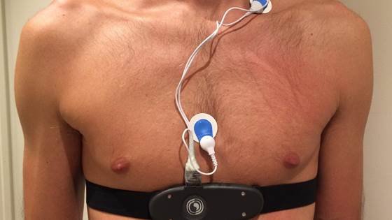 Blodtrykksmåler får innovasjonsstøtte