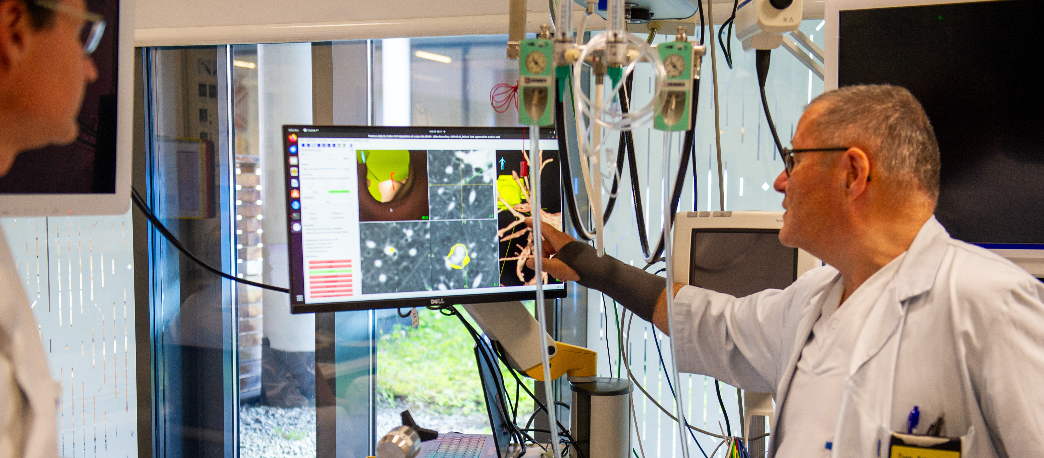 MiDT Lung – Medical Technology for Lung Cancer Diagnostics
