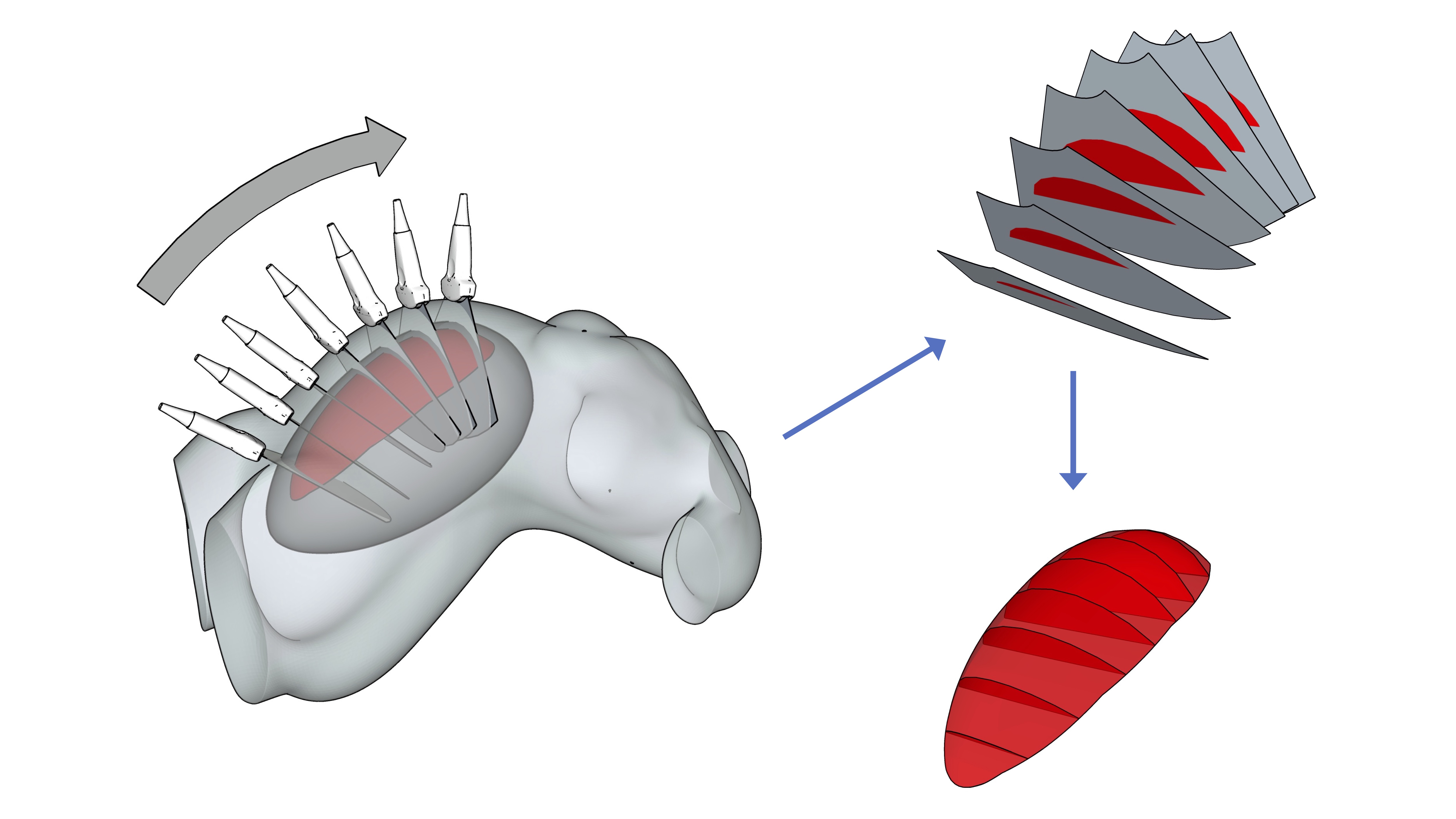RAMPUS 2: Real-Time Accurate Measurement of Placental Volume by Ultrasound