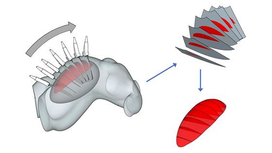 RAMPUS 2: Real-Time Accurate Measurement of Placental Volume by Ultrasound