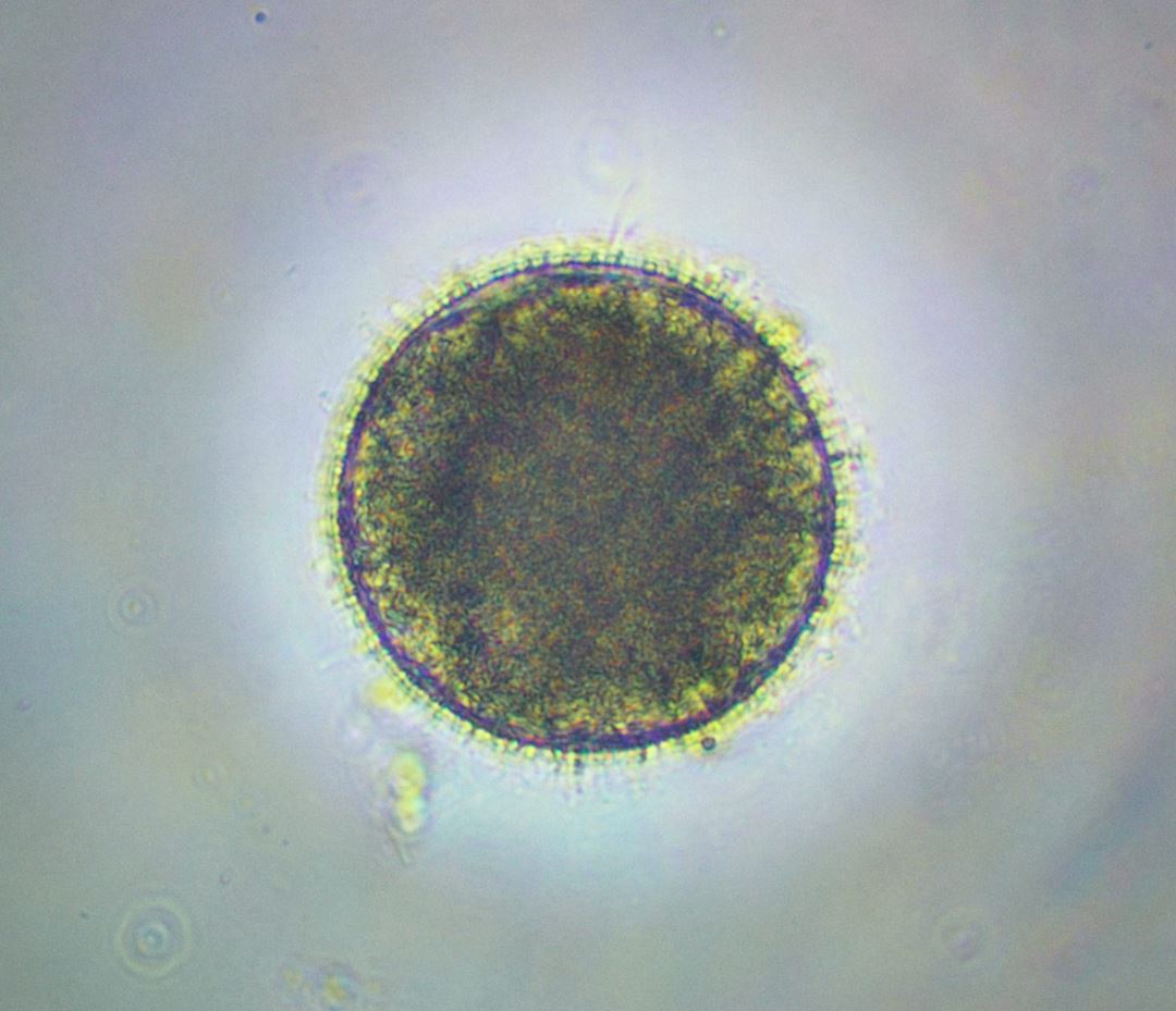 Photo of a copepod egg