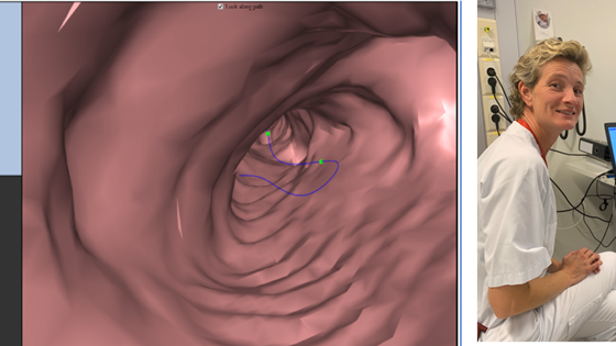 Beslutningsstøtte for lungekreftdiagnostikk