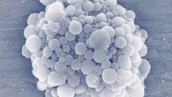 BubbleCAN – Gassbobler for ultralyd-basert kreftbehandling