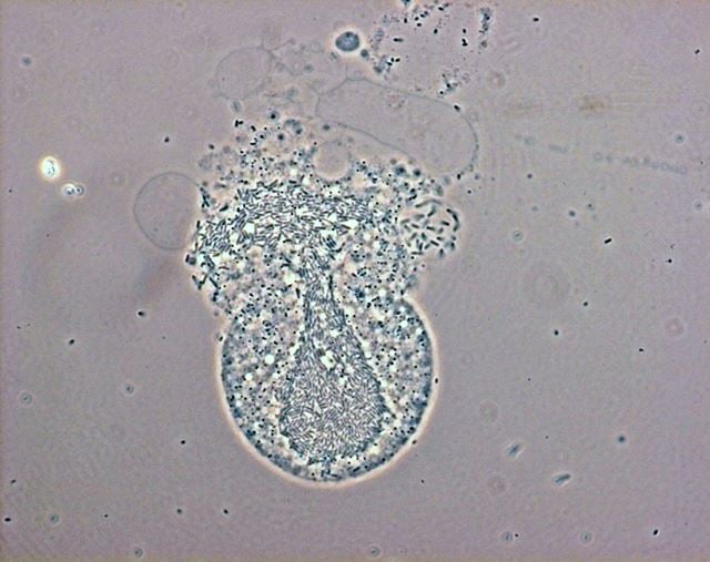 I flere vannprøver fra norske marinefartøy ble det funnet amøber som hadde levende legionella-bakterier inni seg. Bildet er fra et laboratorieforsøk som viser hvordan legionellabakterier frigjøres etter at de har fått amøben til å sprekke. Foto: Forsvarets forskningsinstitutt (FFI)