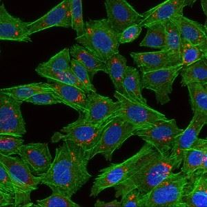 Bildet viser celler som har spist nanopartikler. Cellene er grønne, cellekjernene er blå og det røde er nanopartiklene. Foto: Habib Baghirov, NTNU.