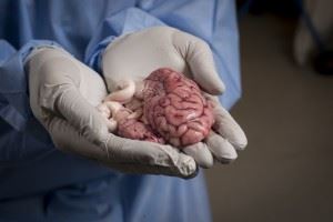 This pig brain will provide researchers with cells that are crucial in helping to get the medicine across the blood-brain barrier. Photo: Geir Otto Johansen.