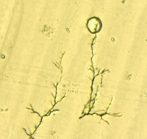 Slik ser &quot;trærne&quot; ut i mikroskopet. Dukker de opp, er det ikke lenge til en kortslutning skjer. Foto: SINTEF 