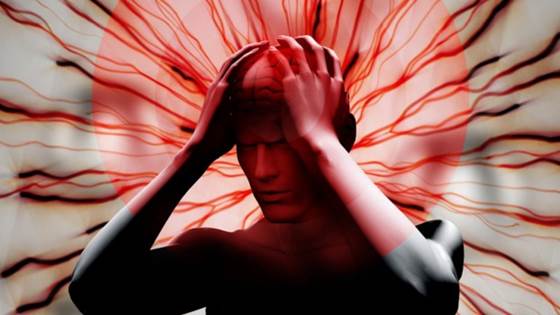 Dette bør du vite om migrene og hodepine