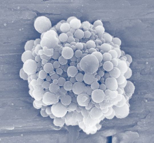 Det nye prosjektet skal utvikle gassbobler som er skreddersydd for ultralyd-basert kreftbehandling. Foto: SINTEF.