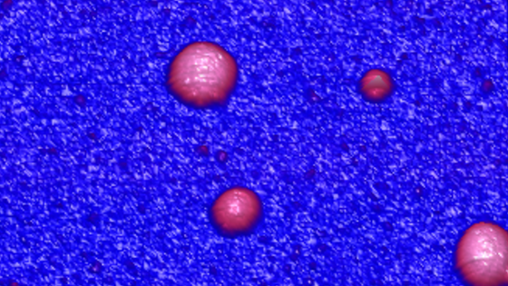 På sporet av Alzheimer-gåten med nanoteknologi?