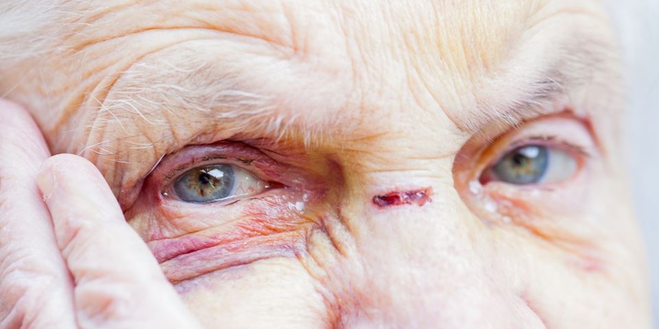 Overgrep mot eldre observeres av de fleste som jobber ved sykehjem. Illustrasjonsfoto: Shutterstock, NTB