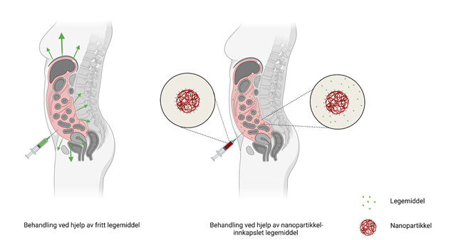 Bukhinnekreft. Illustrasjonen viser hvordan medisinen virker lenger med nano.