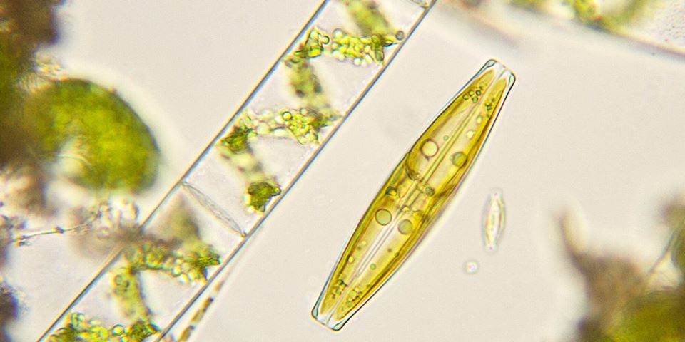 Mikroalger kan vise seg å være en smart klimaløsning. Dette er kiselalger under mikroskopet. Denne algen er i slekt med algene som skal brukes ved Finnfjord Smelteverk. Sistnevnte er imidlertid en forretningshemmelighet. Foto: iStock