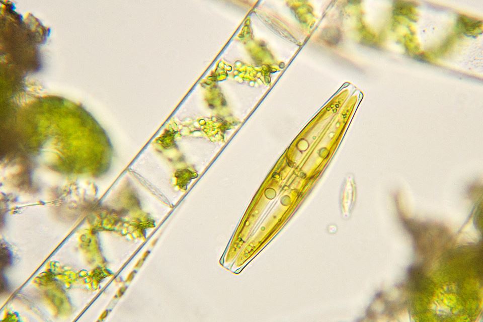 Mikroalger kan vise seg å være en smart klimaløsning. Dette er kiselalger under mikroskopet. Denne algen er i slekt med algene som skal brukes ved Finnfjord Smelteverk. Sistnevnte er imidlertid en forretningshemmelighet. Foto: iStock