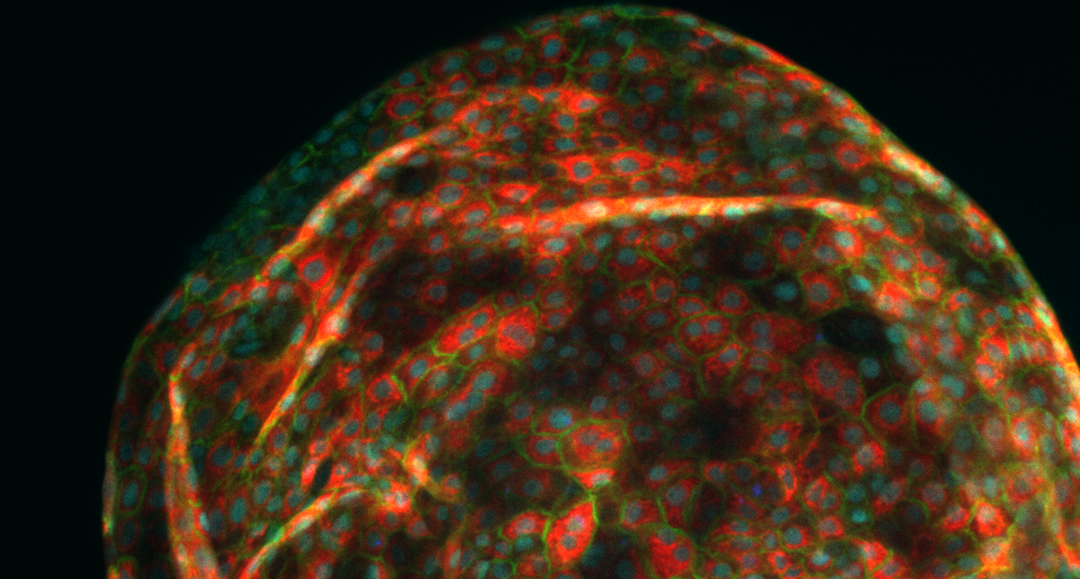 Organoide av leverceller framstillt i laben. Mikroskopbildet viser leveren som vokser fram og cellene har ulike farger.