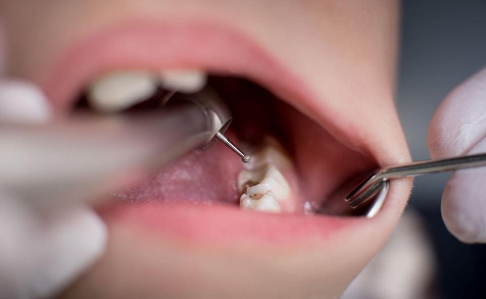 I Norge skal tannhelsepersonell bruke såkalte motiverende intervju for å forebygge dårlig tannhelse hos barn og unge. Men ordningen fungerer ikke godt nok, viser forskning. Illustrasjonsfoto: Anatoly Gleb/ iStock