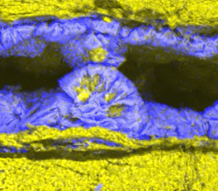 Mineralet dypingitt  i elektronmikroskop. Foto: SINTEF