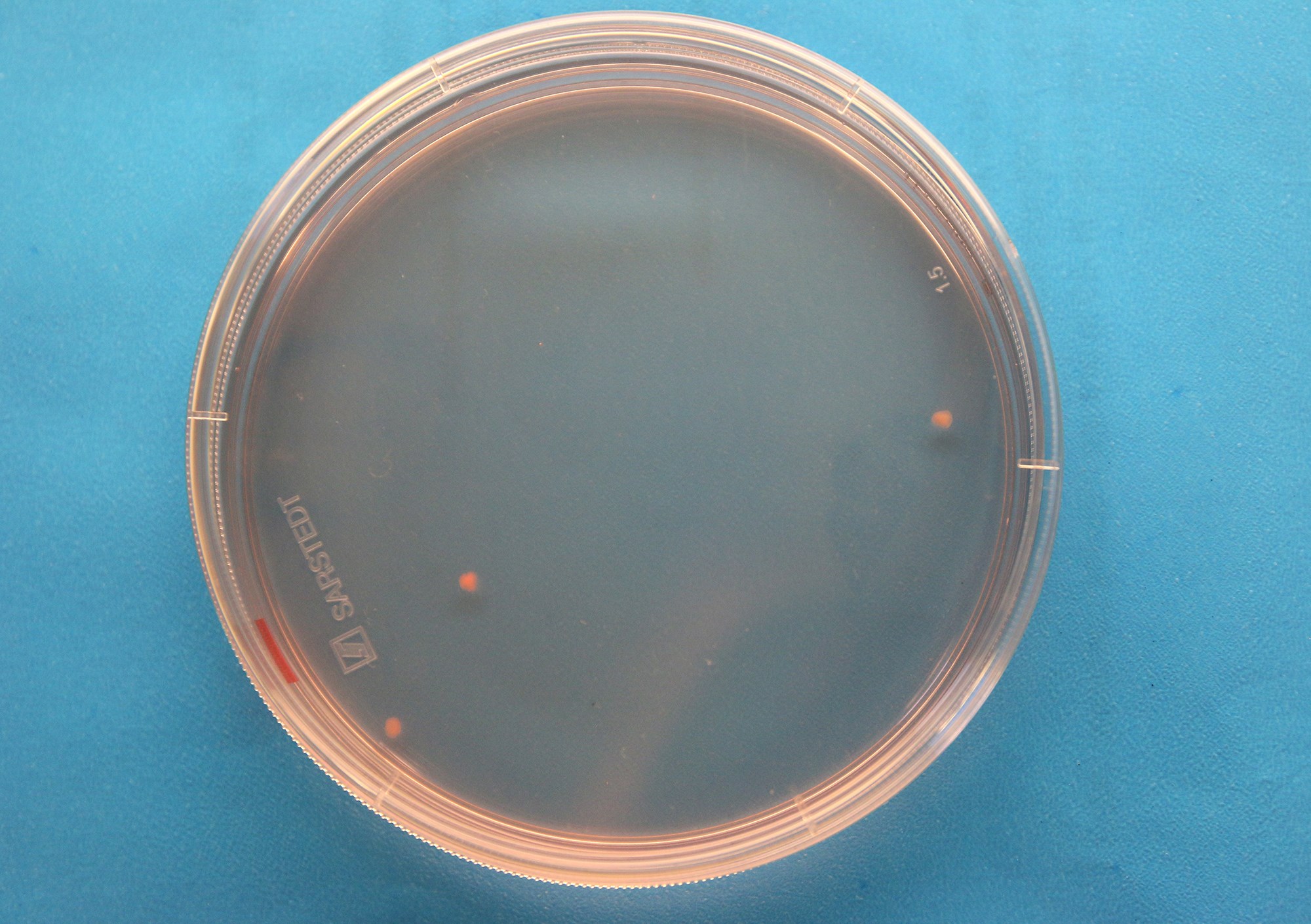 Miniorganer gir håp om behandling av sykdommer