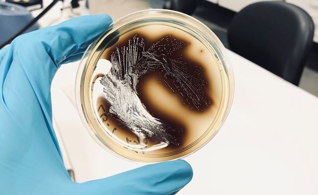 Bildet viser en petriskål med bakterier.