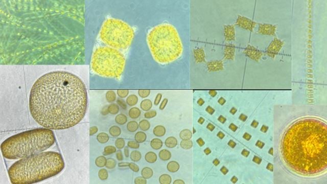 Slik ser de små algene ut gjennom linsa på et mikroskop. Foto: M2RG/UiT