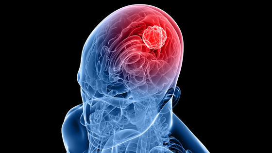 Norwegian superfluid is now helping brain surgeons