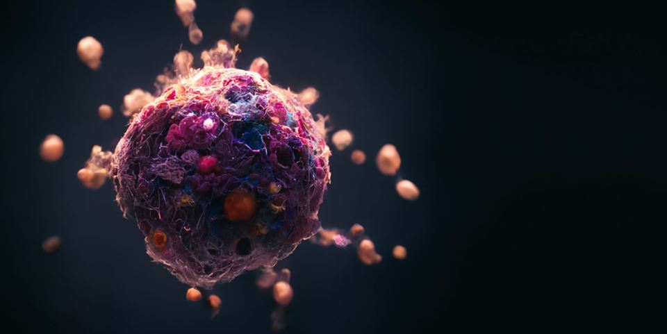 The company NaDeNo is developing a safer and more effective treatment for peritoneal cancer by encapsulating anti-cancer cytotoxins in nanoparticle carriers. The illustration shows a cancer cell and the nanoparticle carriers. Stock photo: Shutterstock
