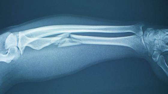 AI could become the healthcare system’s own medicine