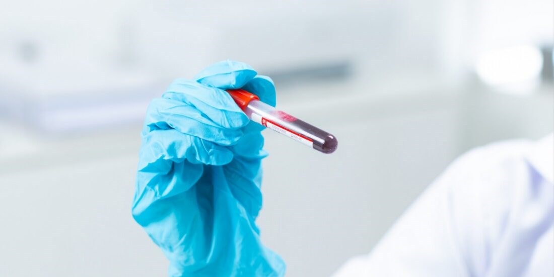 Beyond the petri dish: Testing tomorrow’s drugs in human blood